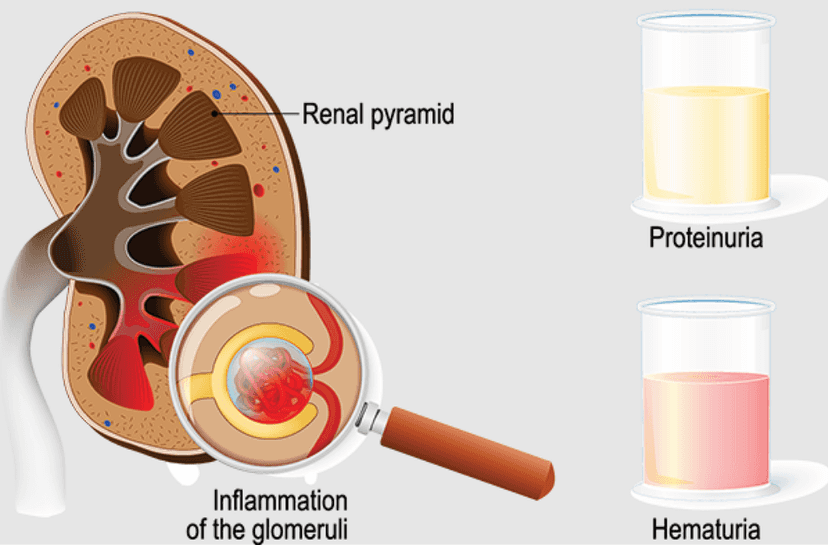 Disease image